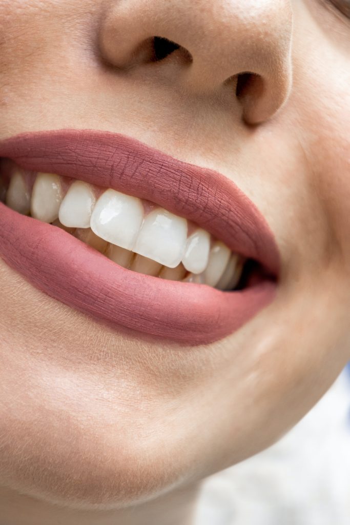 Blogs 4 removable retainer options in Islington