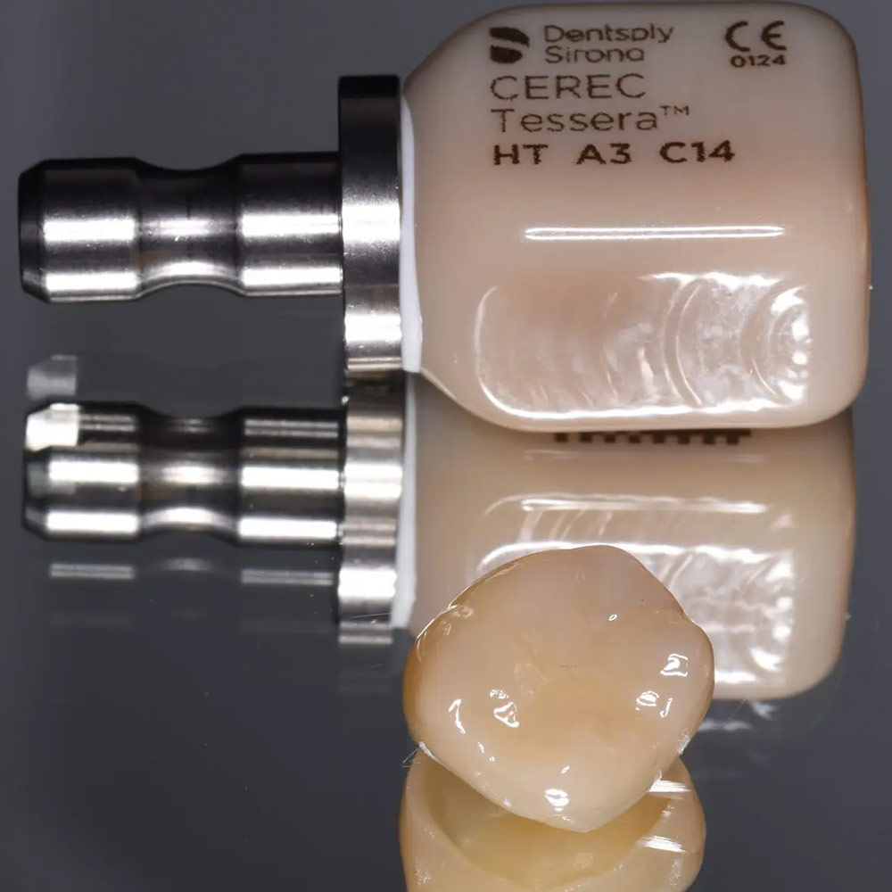 cerec same day crown angel smile london