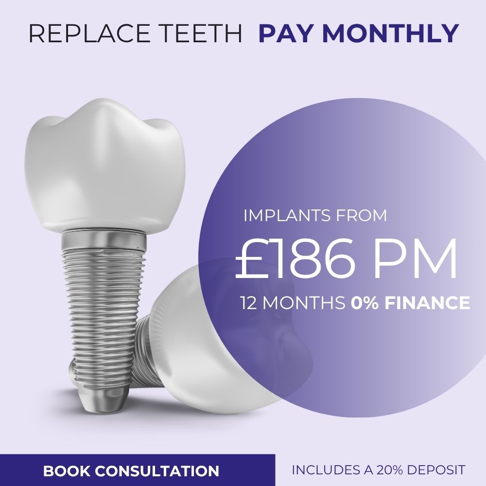 dental implant costs in london