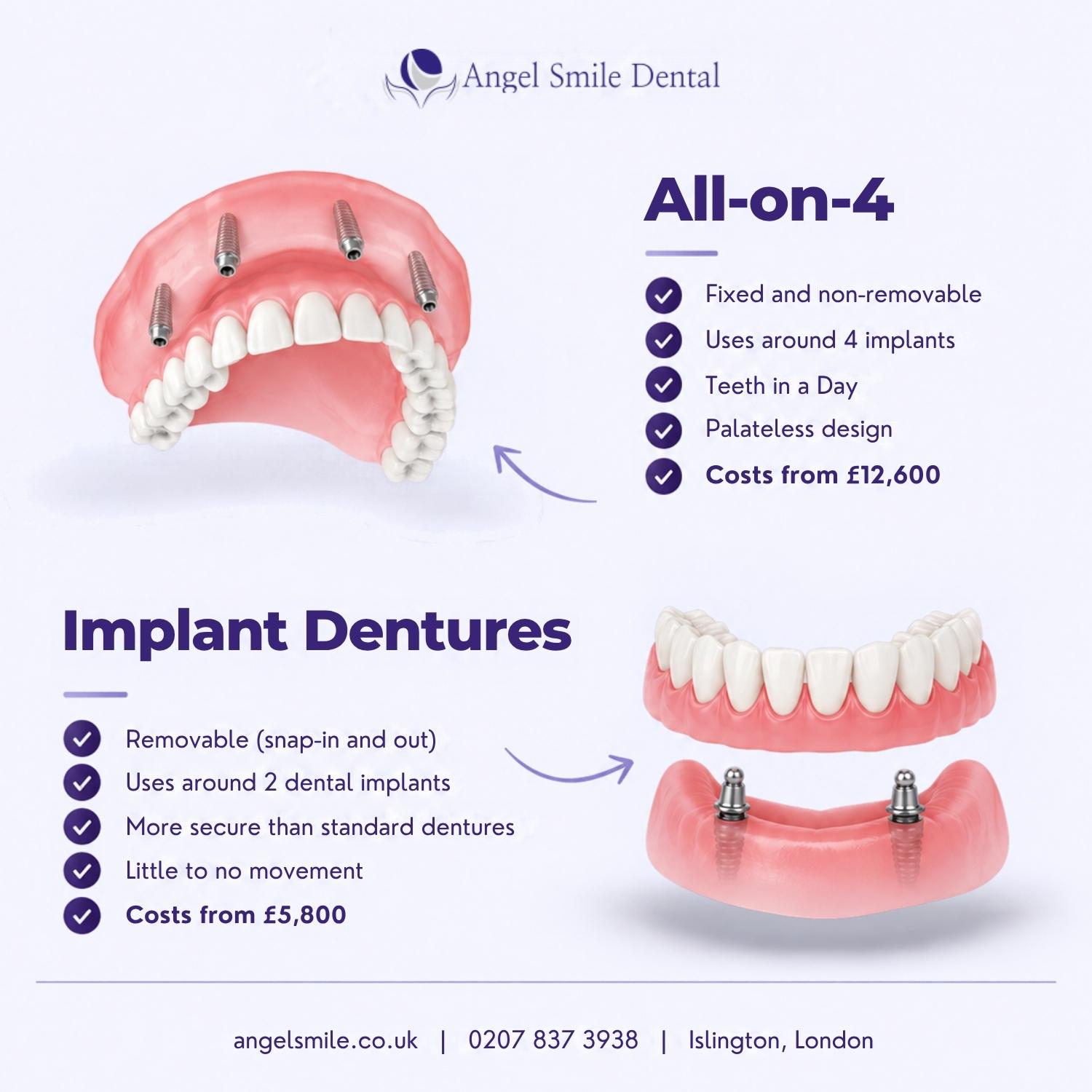 implant dentures vs all on 4 implants